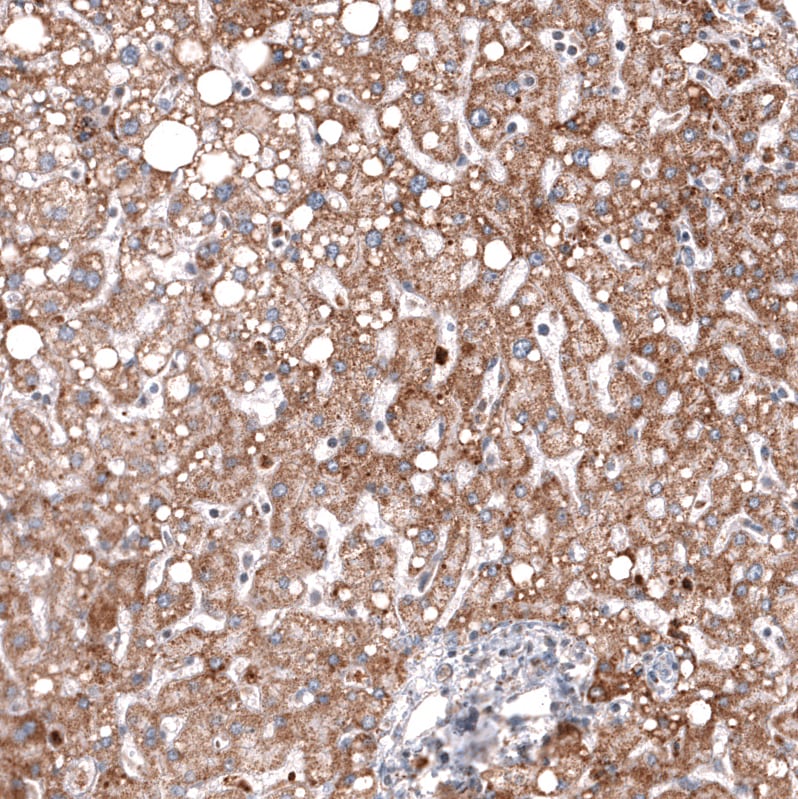 Immunohistochemistry-Paraffin: Chitinase 3-like 1 Antibody [NBP3-21212] -