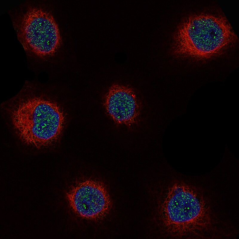 Immunocytochemistry/Immunofluorescence: Cyclin D1 Antibody [NBP3-21213] -