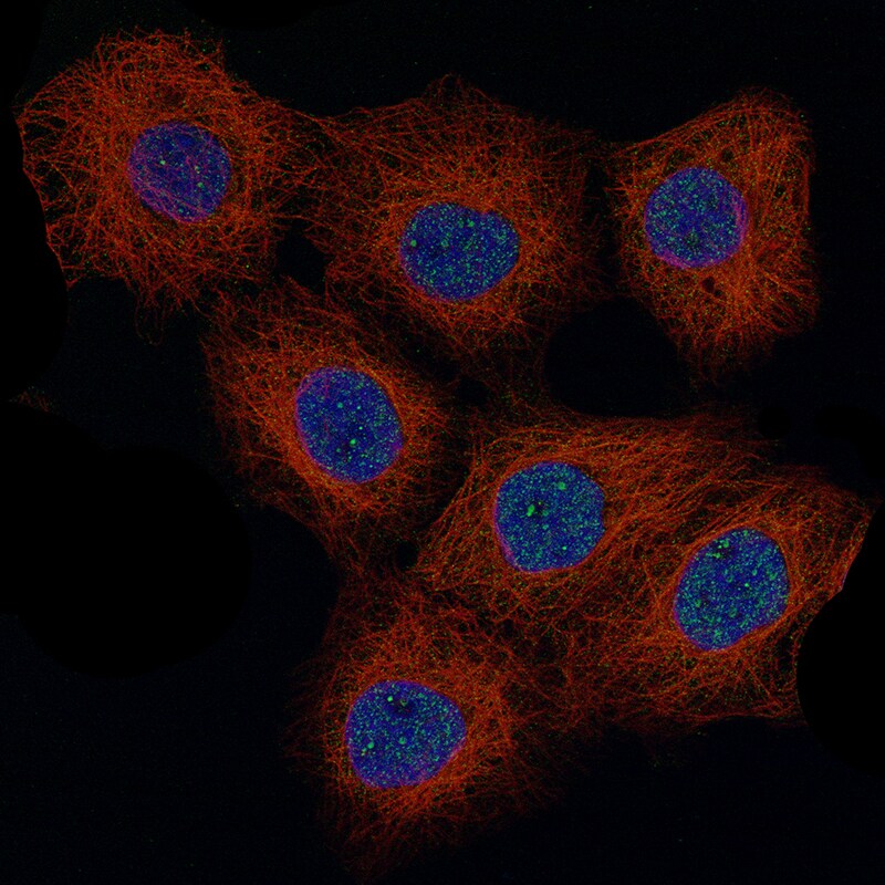 Immunocytochemistry/Immunofluorescence: Cyclin D1 Antibody [NBP3-21214] -