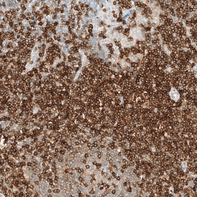 Immunohistochemistry-Paraffin: CD5 Antibody [NBP3-21215] -