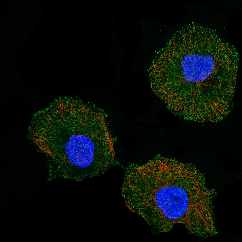 Immunocytochemistry/Immunofluorescence: CD5 Antibody [NBP3-21215] -