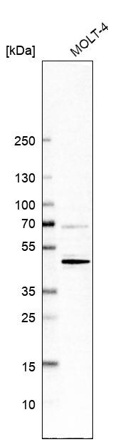 Western Blot: CD5 Antibody [NBP3-21215] -