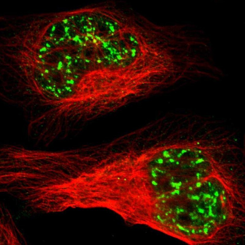 Immunocytochemistry/Immunofluorescence: MBD4 Antibody [NBP3-21219] -