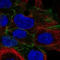 Immunocytochemistry/Immunofluorescence: Cadherin-6/KCAD Antibody [NBP3-21220] -