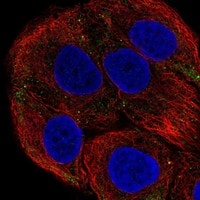 Laminin beta 3 Antibody - BSA Free Immunocytochemistry/ Immunofluorescence: Laminin beta 3 Antibody - BSA Free [NBP3-21221]