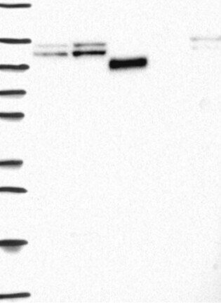 Western Blot: VE-Cadherin Antibody [NBP3-21223] -
