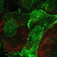 Immunocytochemistry/Immunofluorescence: VE-Cadherin Antibody [NBP3-21223] -
