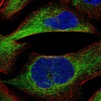 Immunocytochemistry/Immunofluorescence: PKC epsilon Antibody [NBP3-21224] -