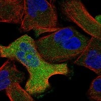Immunocytochemistry/Immunofluorescence: Annexin A6 Antibody [NBP3-21228] -