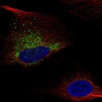Immunocytochemistry/Immunofluorescence: Collagen I alpha 1 Antibody [NBP3-21230] -