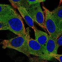 Immunocytochemistry/Immunofluorescence: MAP2 Antibody [NBP3-21231] -