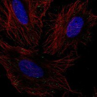 Immunocytochemistry/Immunofluorescence: GLT8D2 Antibody [NBP3-21232] -