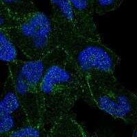 Immunocytochemistry/Immunofluorescence: APC Antibody [NBP3-21233] -