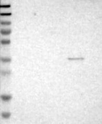 Western Blot: DNAM-1/CD226 Antibody [NBP3-21236] -