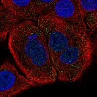 Immunocytochemistry/Immunofluorescence: Follistatin Antibody [NBP3-21237] -