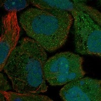 GPER/GPR30 Antibody - BSA Free Immunocytochemistry/ Immunofluorescence: GPER/GPR30 Antibody - BSA Free [NBP3-21238]