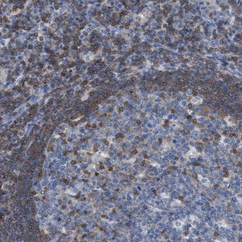Immunohistochemistry-Paraffin: IL-16 Antibody [NBP3-21240] -