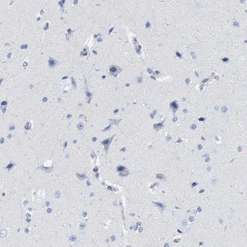 Immunohistochemistry-Paraffin: IL-16 Antibody [NBP3-21240] -