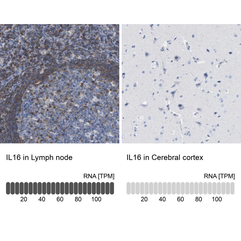 Immunohistochemistry-Paraffin: IL-16 Antibody [NBP3-21240] -