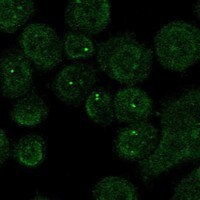 Immunocytochemistry/Immunofluorescence: Chimaerin 2 Antibody [NBP3-21241] -