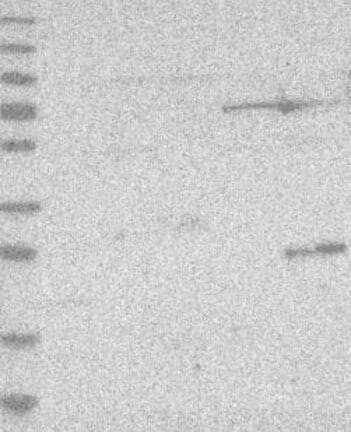 Western Blot: IL-33 Antibody [NBP3-21242] -