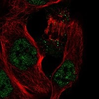 Immunocytochemistry/Immunofluorescence: IL-33 Antibody [NBP3-21242] -