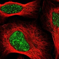 SIRT7 Antibody - BSA Free Immunocytochemistry/ Immunofluorescence: SIRT7 Antibody - BSA Free [NBP3-21247]