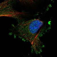 Immunocytochemistry/Immunofluorescence: LAMP-2/CD107b Antibody [NBP3-21250] -
