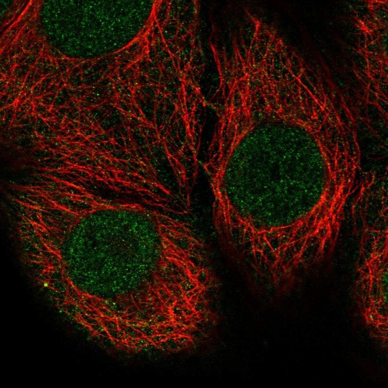 Immunocytochemistry/Immunofluorescence: PTEN Antibody [NBP3-21254] -