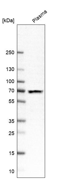 Western Blot: PTEN Antibody [NBP3-21254] -