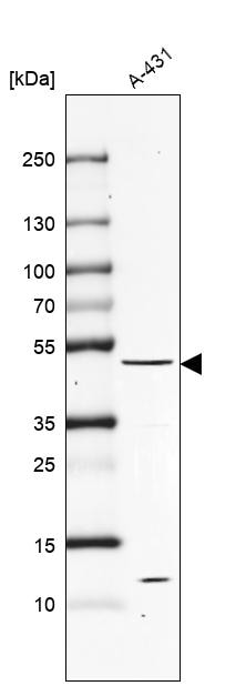 Western Blot: PTEN Antibody [NBP3-21254] -