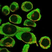 Immunocytochemistry/Immunofluorescence: PAR4 Antibody [NBP3-21255] -