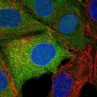 TRPM7 Antibody - BSA Free Immunocytochemistry/ Immunofluorescence: TRPM7 Antibody - BSA Free [NBP3-21259]