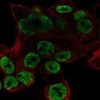 Immunocytochemistry/Immunofluorescence: ODAM Antibody [NBP3-21260] -