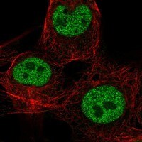 Immunocytochemistry/Immunofluorescence: CDX4 Antibody [NBP3-21268] -