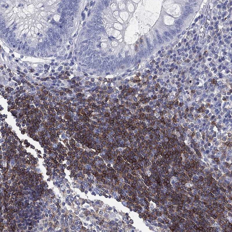Immunohistochemistry-Paraffin: CD79B Antibody [NBP3-21270] -