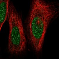 Immunocytochemistry/Immunofluorescence: LIM1 Antibody [NBP3-21271] -