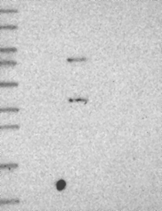 Western Blot: Complement Component C5aR1 Antibody [NBP3-21274] -