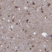 Immunohistochemistry-Paraffin: SUR-8 Antibody [NBP3-21275] -