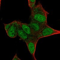 Immunocytochemistry/Immunofluorescence: Islet-1 Antibody [NBP3-21276] -