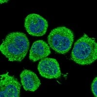 Immunocytochemistry/Immunofluorescence: GAD1/GAD67 Antibody [NBP3-21278] -