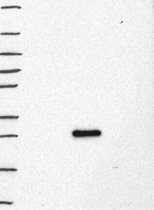 Western Blot: LMO2 Antibody [NBP3-21296] -