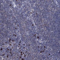 Immunohistochemistry-Paraffin: CD155/PVR Antibody [NBP3-21304] -