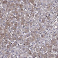Immunohistochemistry-Paraffin: Hemopexin Antibody [NBP3-21306] -