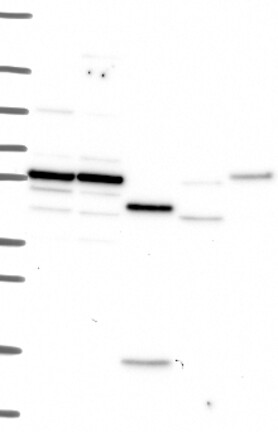 Western Blot: IL-10R alpha Antibody [NBP3-21308] -