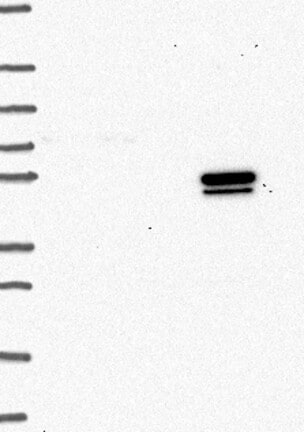 Western Blot: IL-7R alpha/CD127 Antibody [NBP3-21313] -