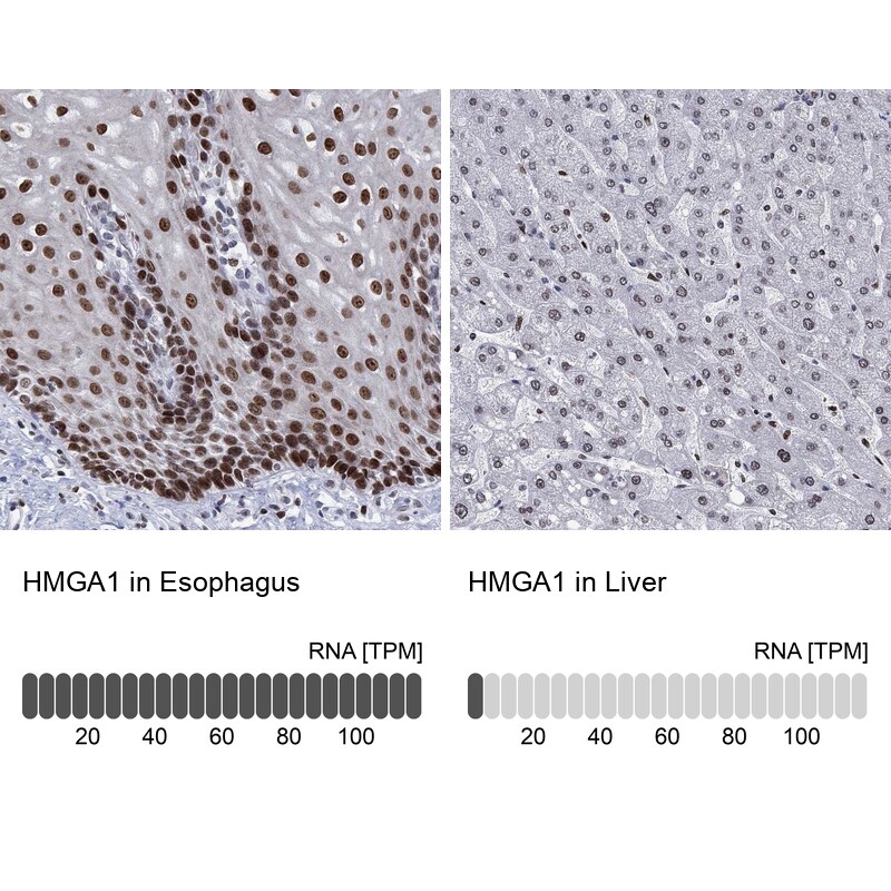 Immunohistochemistry-Paraffin: HMGA1 Antibody [NBP3-21318] -