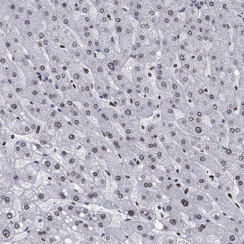 Immunohistochemistry-Paraffin: HMGA1 Antibody [NBP3-21318] -