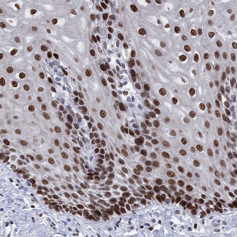 Immunohistochemistry-Paraffin: HMGA1 Antibody [NBP3-21318] -