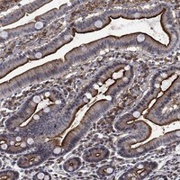 Immunohistochemistry-Paraffin: DPPIV/CD26 Antibody [NBP3-21319] -